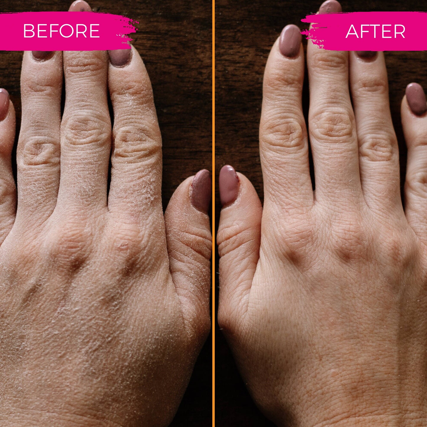 Viori Beauty - Limited Edition | Sugar Scrub Bar | Peach Hibiscus